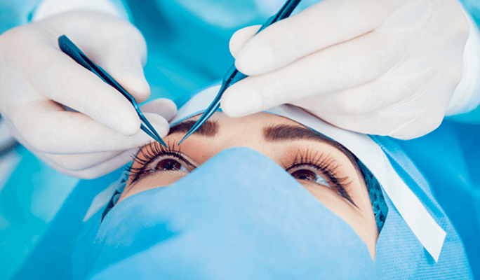Glaucoma Surgery