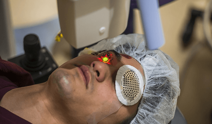 Macular Degeneration