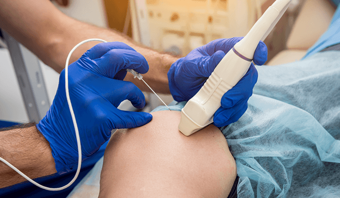 Radiofrequency Lesioning