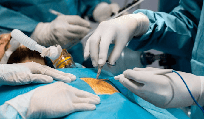 Laparoscopic Hiatal Hernia Repair Procedure