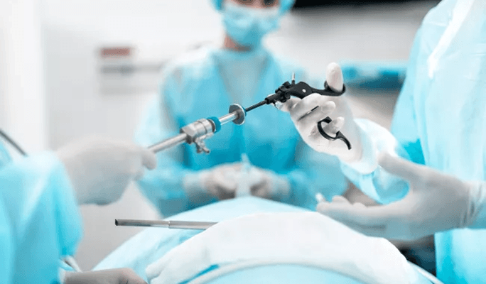 Laparoscopic Colectomy
