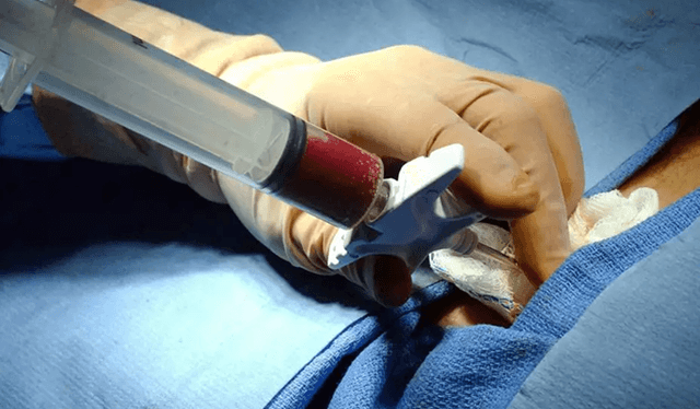 Hematopoietic Stem Cell Transplantation