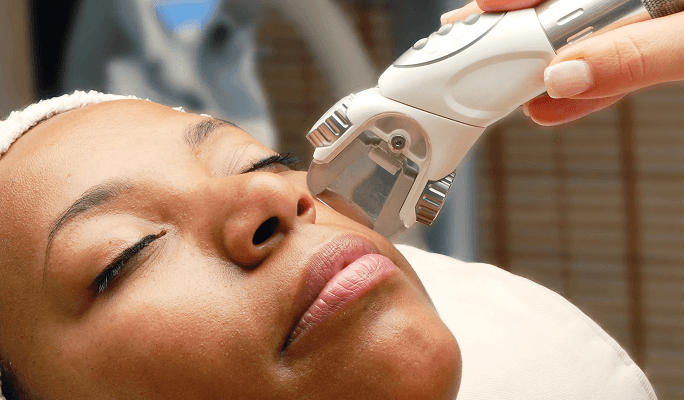 Skin Laser Therapy