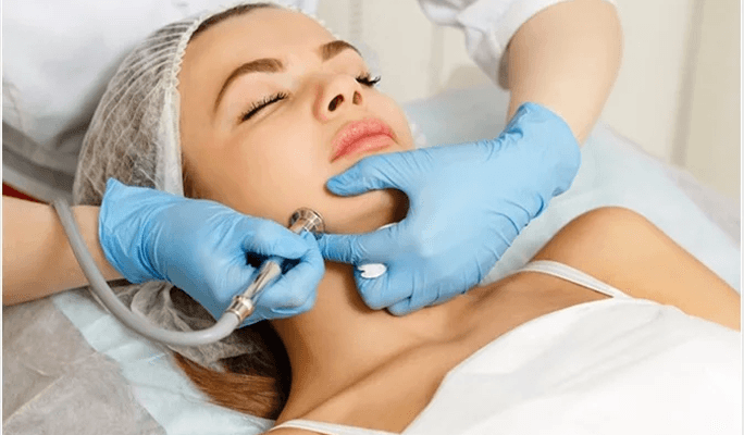 Dermabrasion