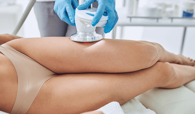 Cellulite Removal