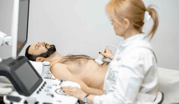 Renal Artery Angioplasty