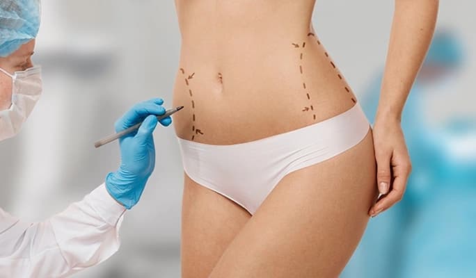 Body Contouring