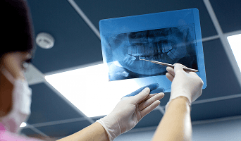 Dental Bone Graft