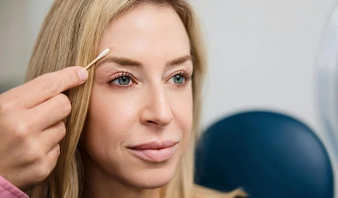 Brow Lift