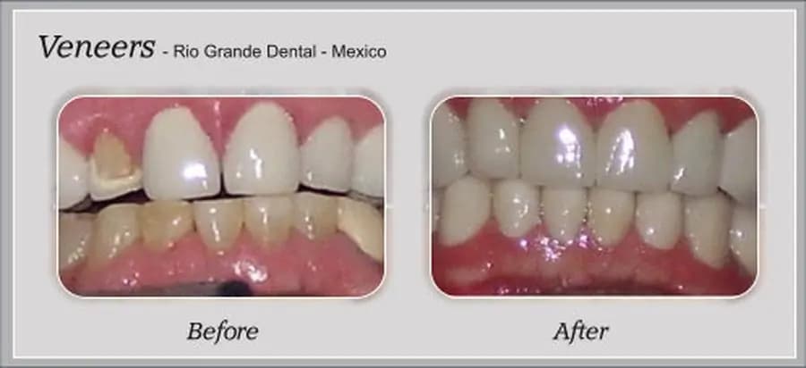 Rio Grande Dental - Image 3