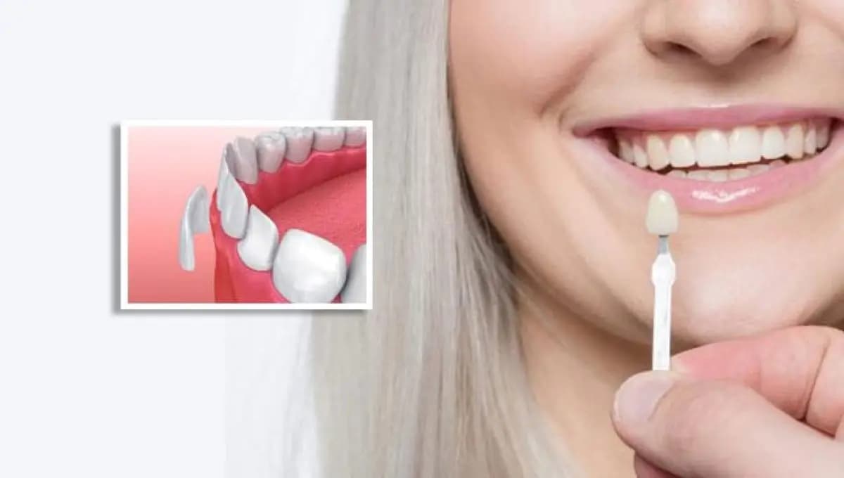 A.B. Dental Studio - Image 3