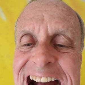 Full Mouth Reconstruction