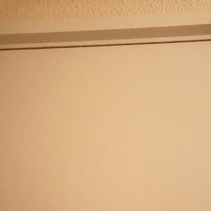 FUE Hair Transplant