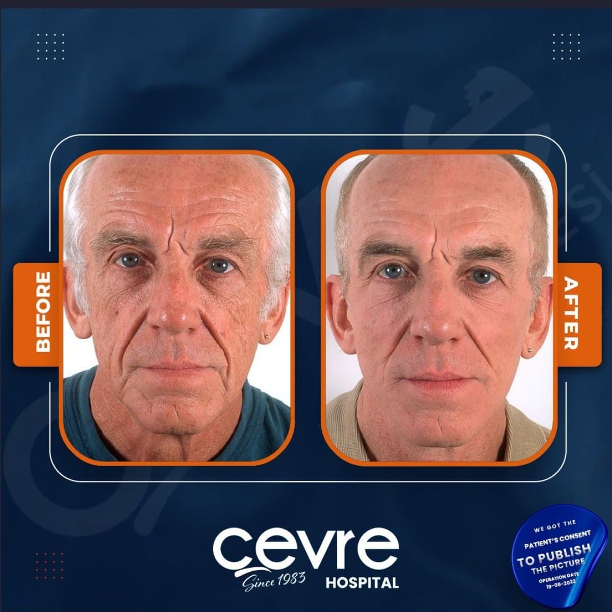 results