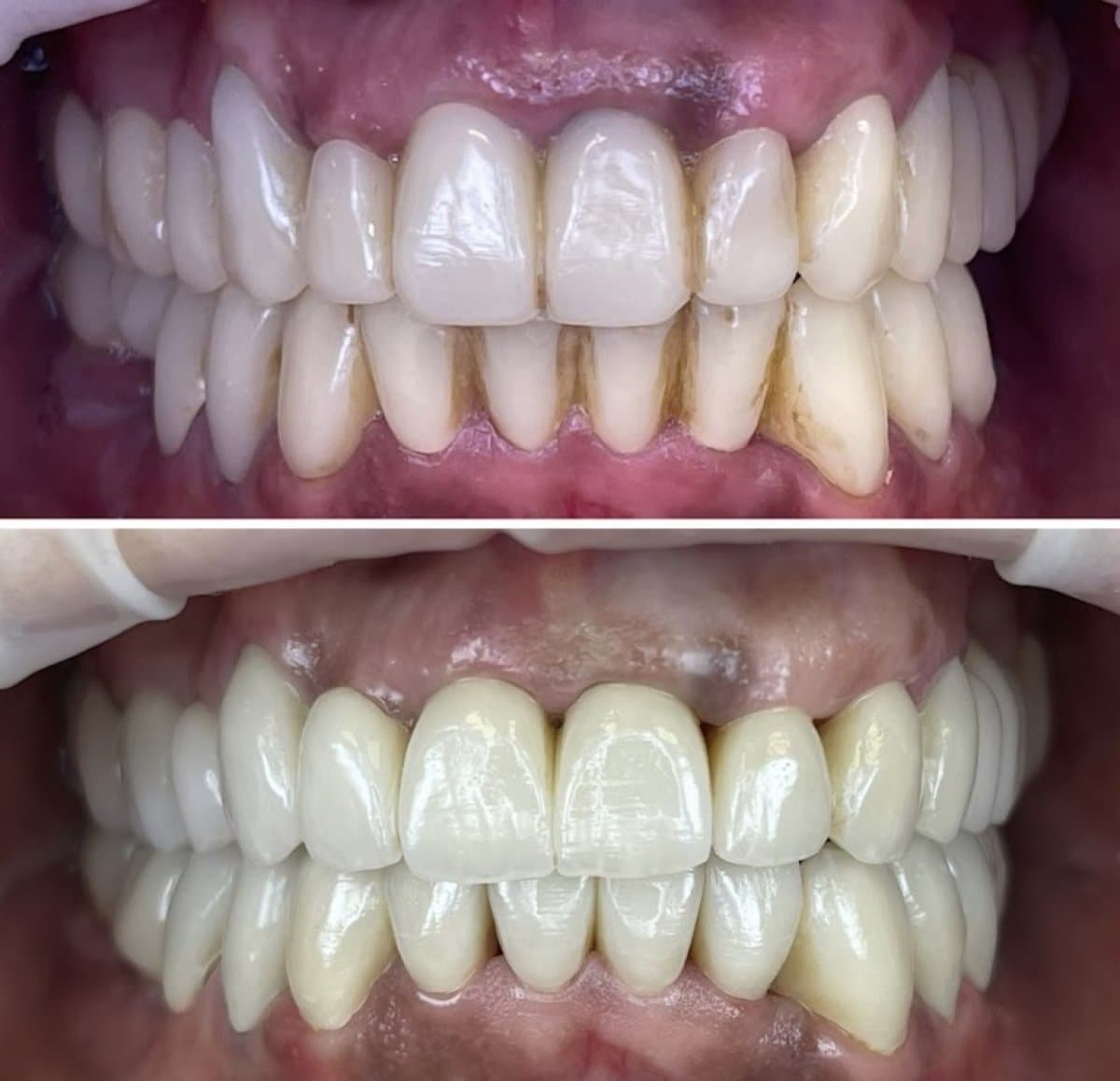 smile makeover