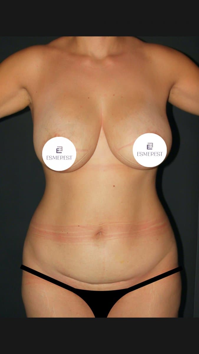 Transformative Results