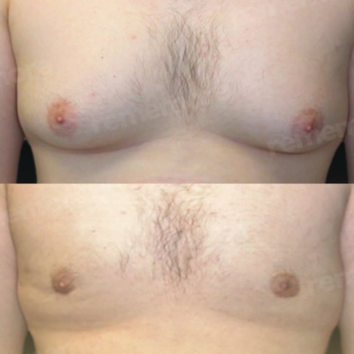 results