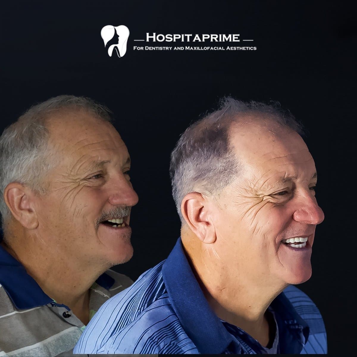 orthognathic surgery
