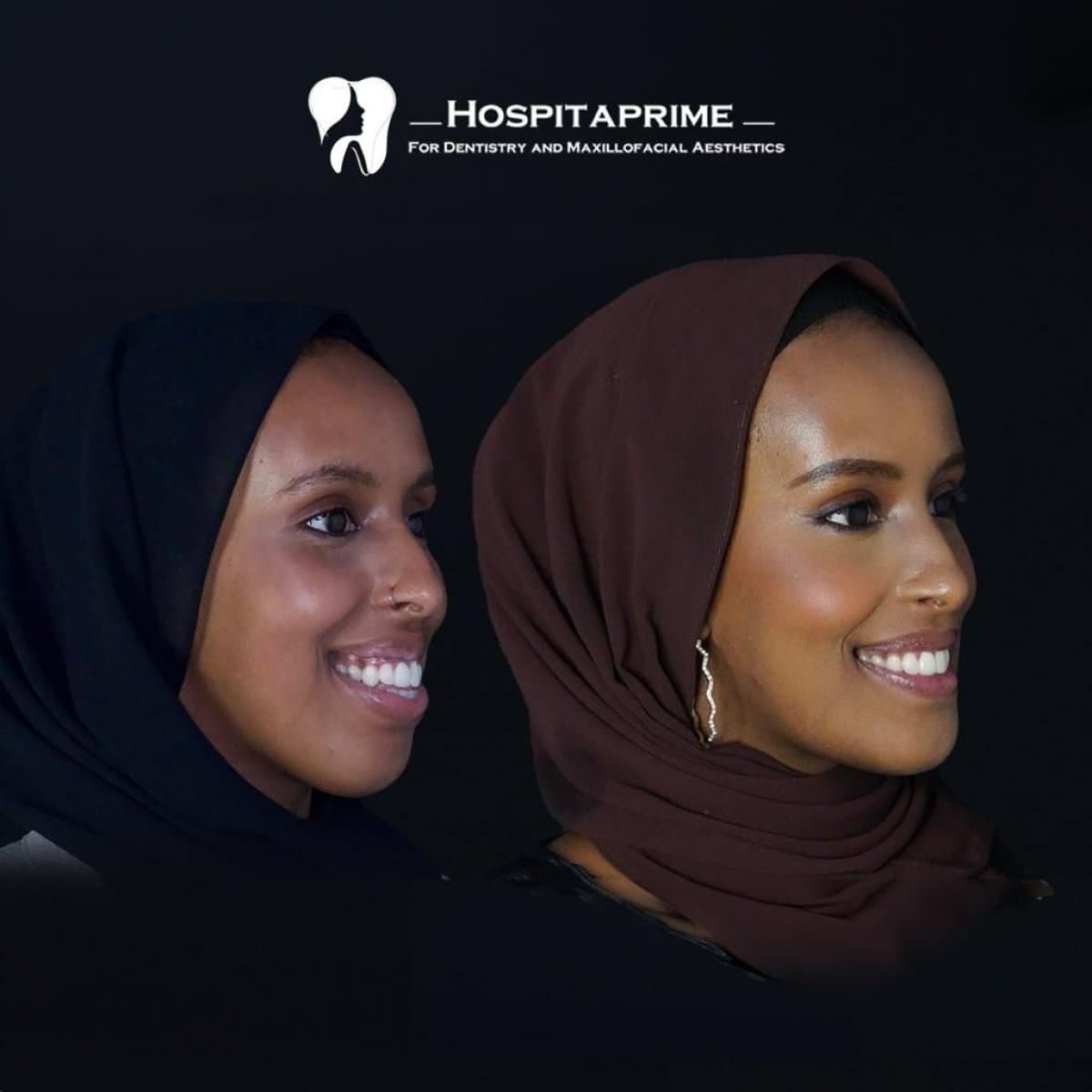 mandibular osteotomy