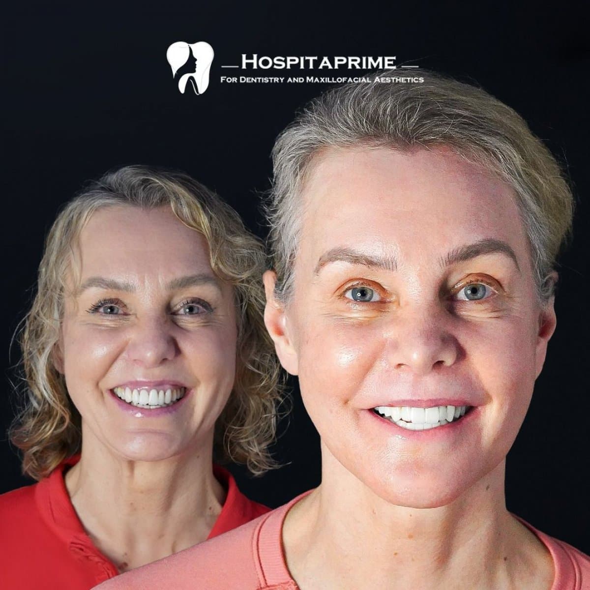 All-on-4 dental implants