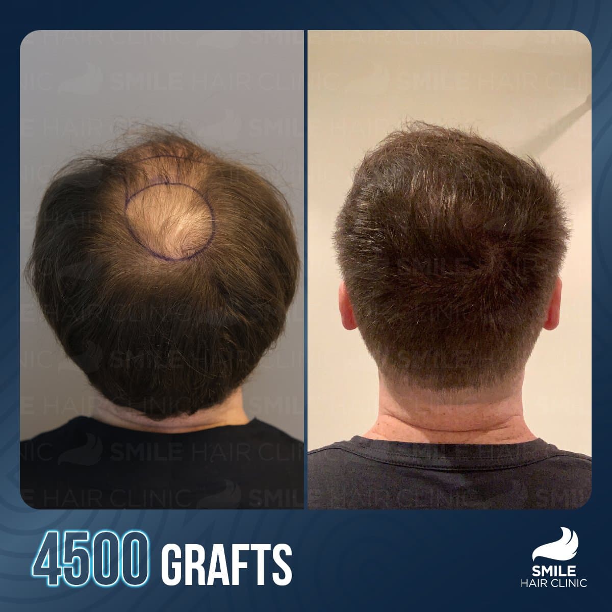 Transformative Results