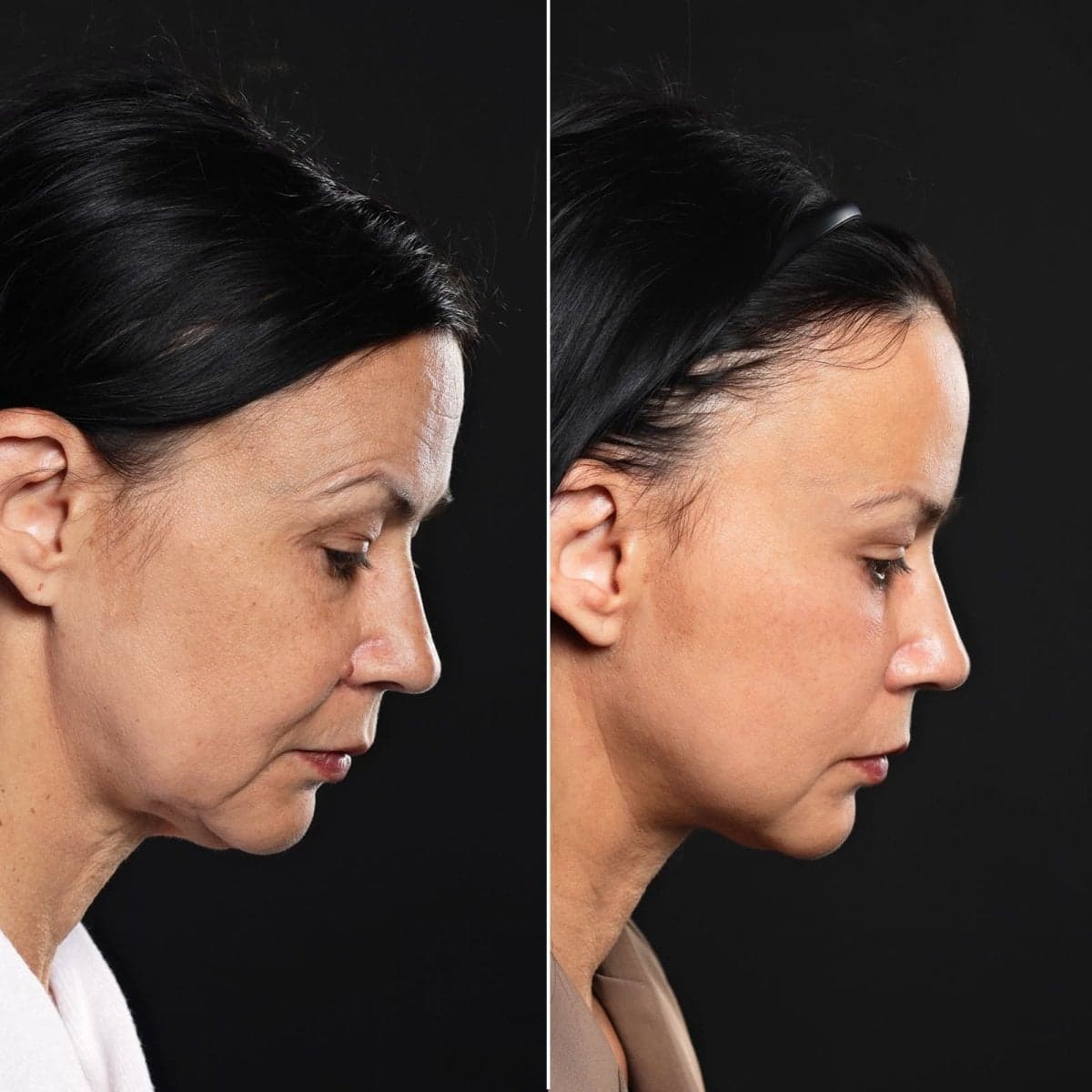 Transformative Results