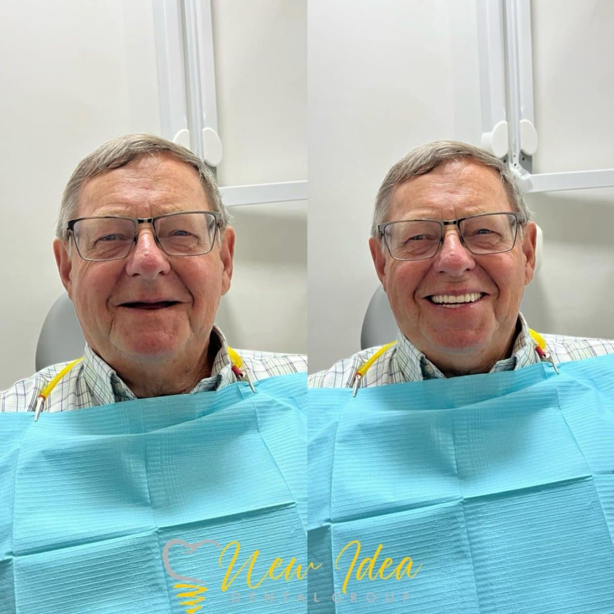 tooth extraction