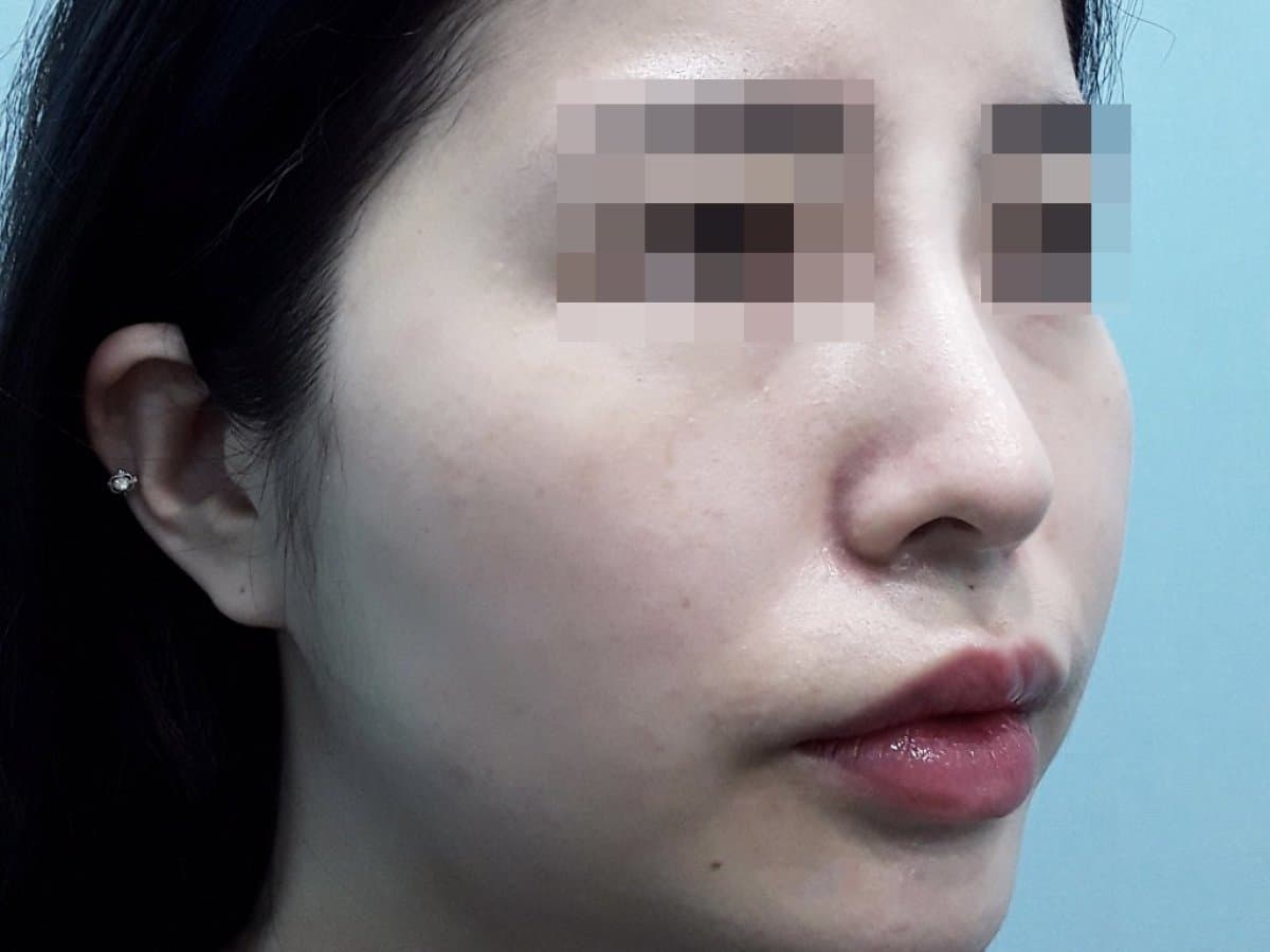 Transformative Results