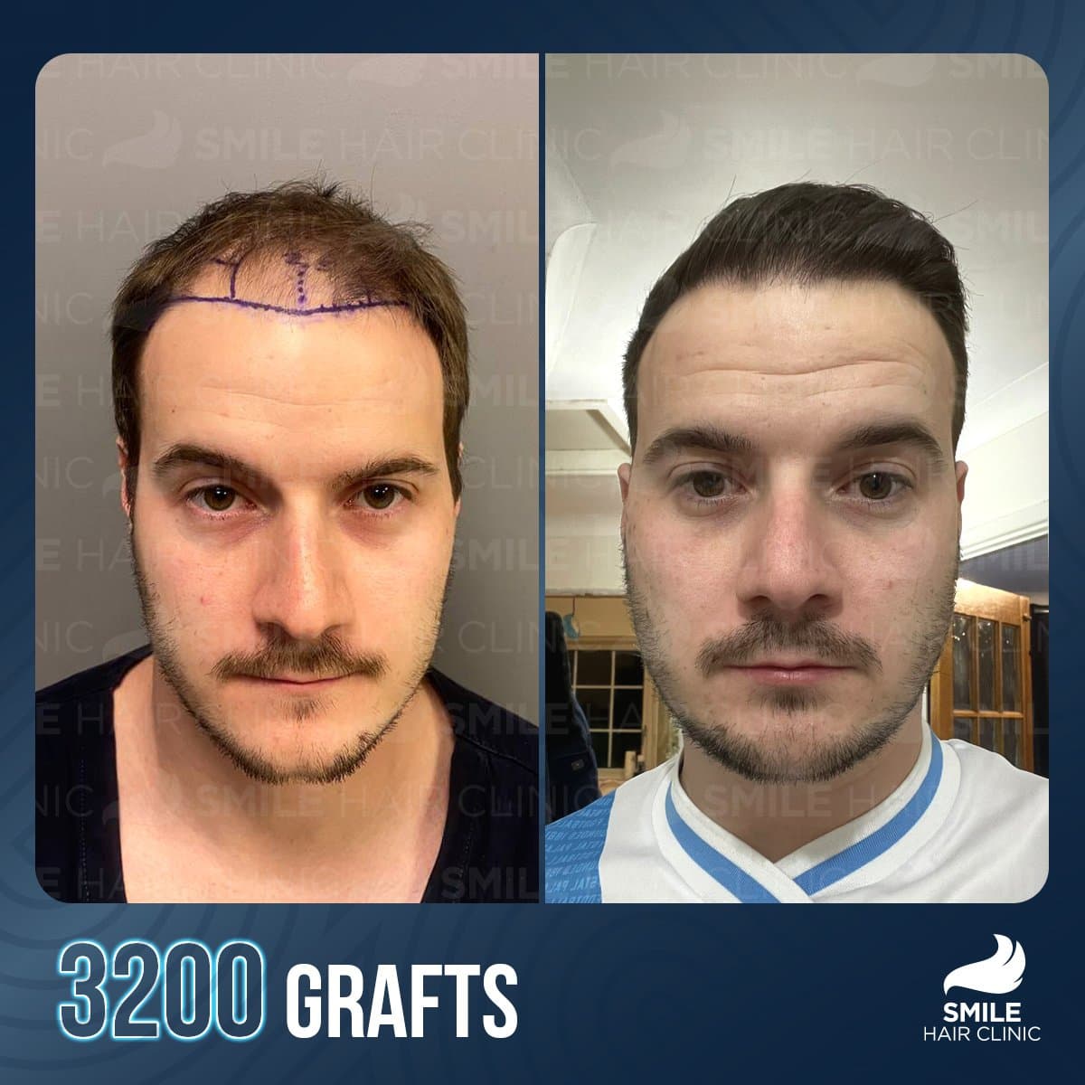 result