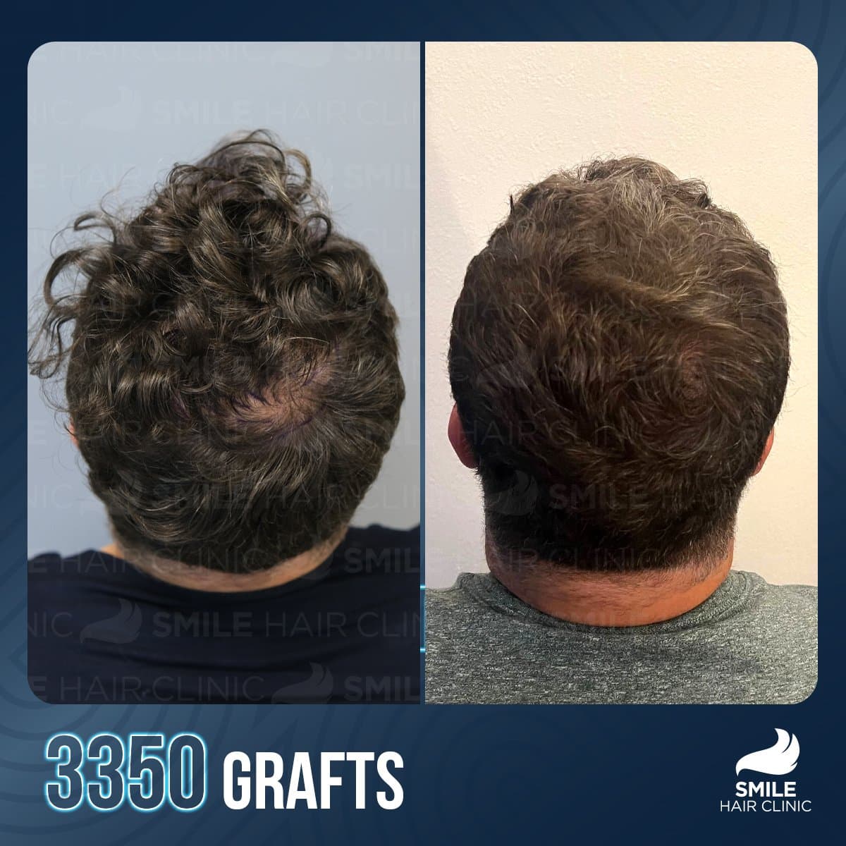 Transformative Results