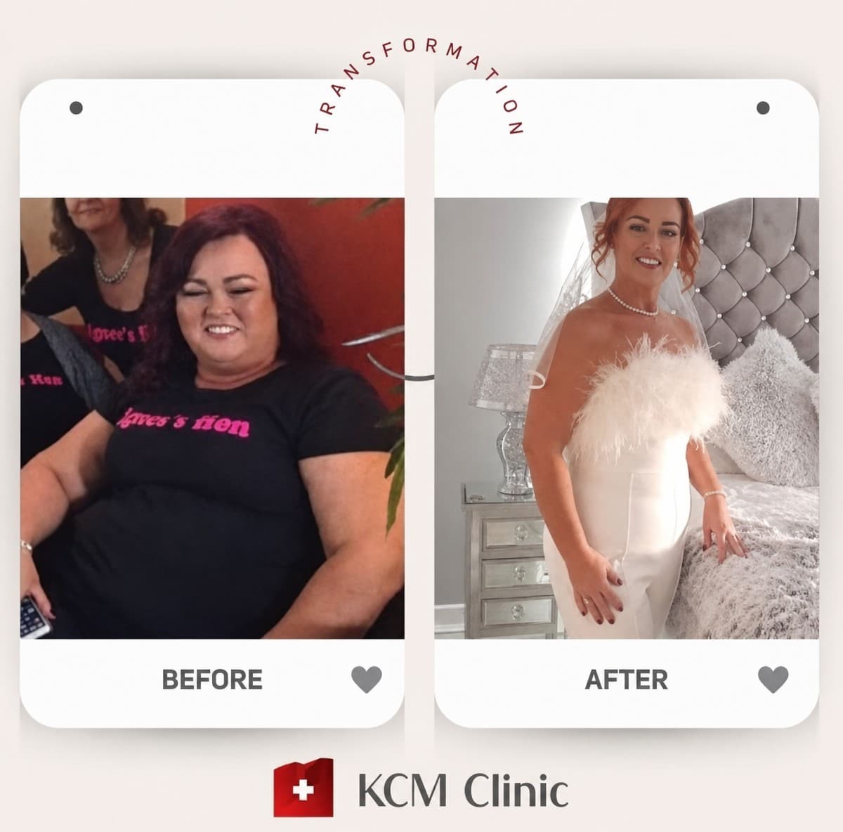 gastric balloon