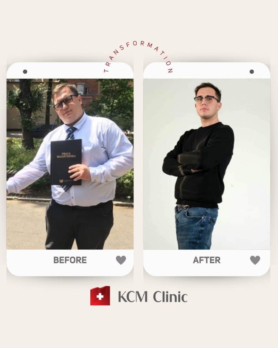 gastric balloon