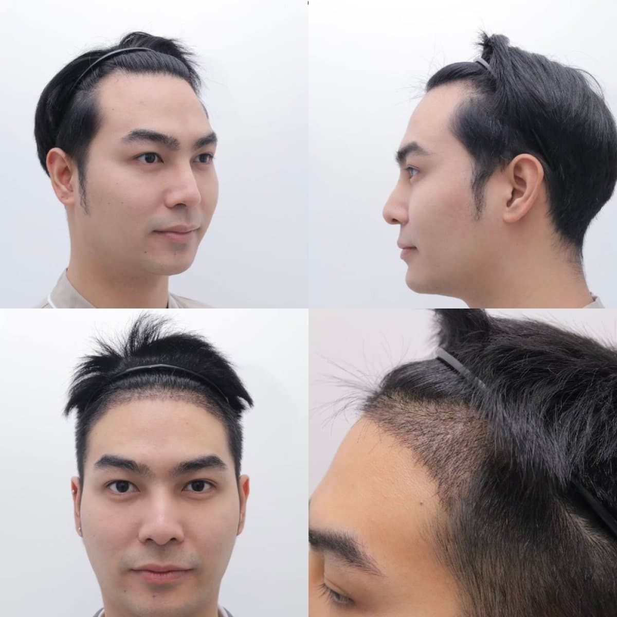 Transformative Results
