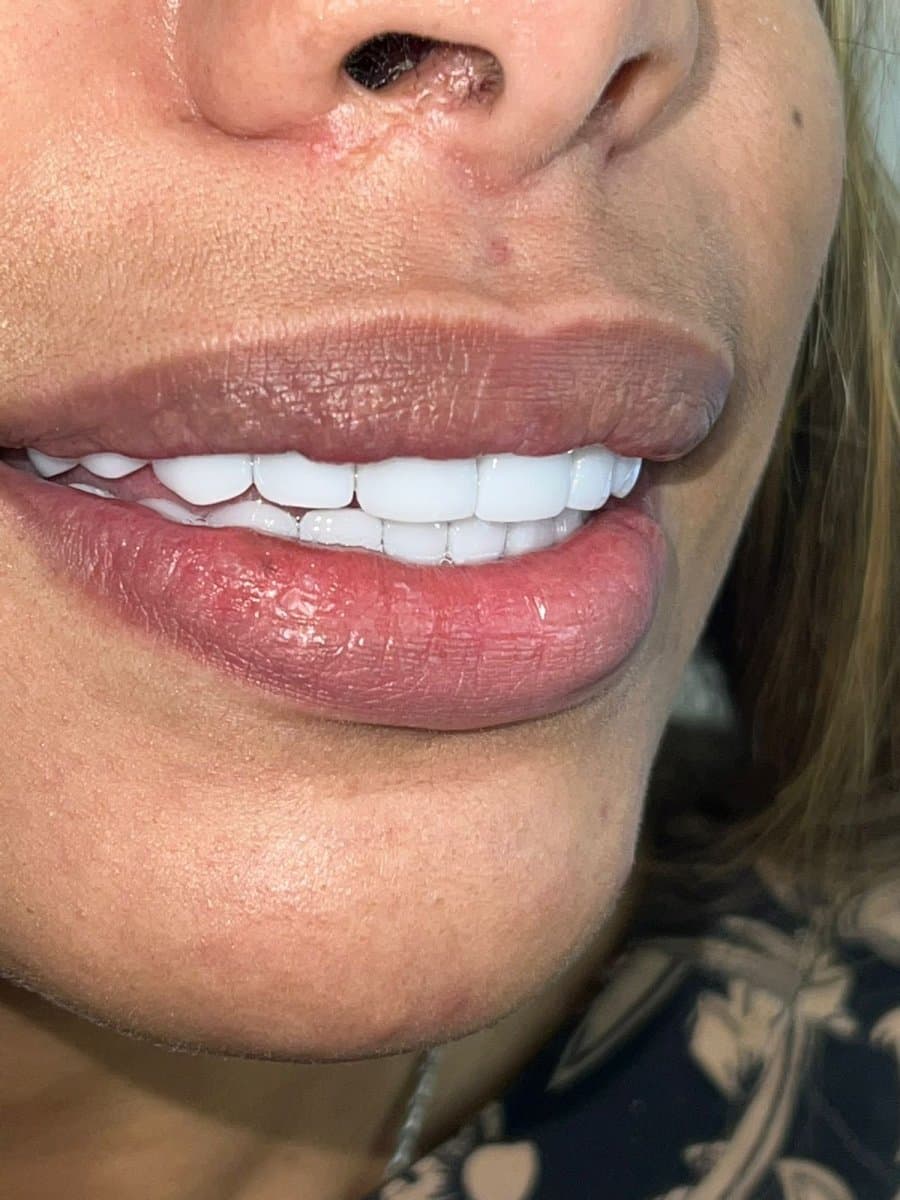 Transformative Results