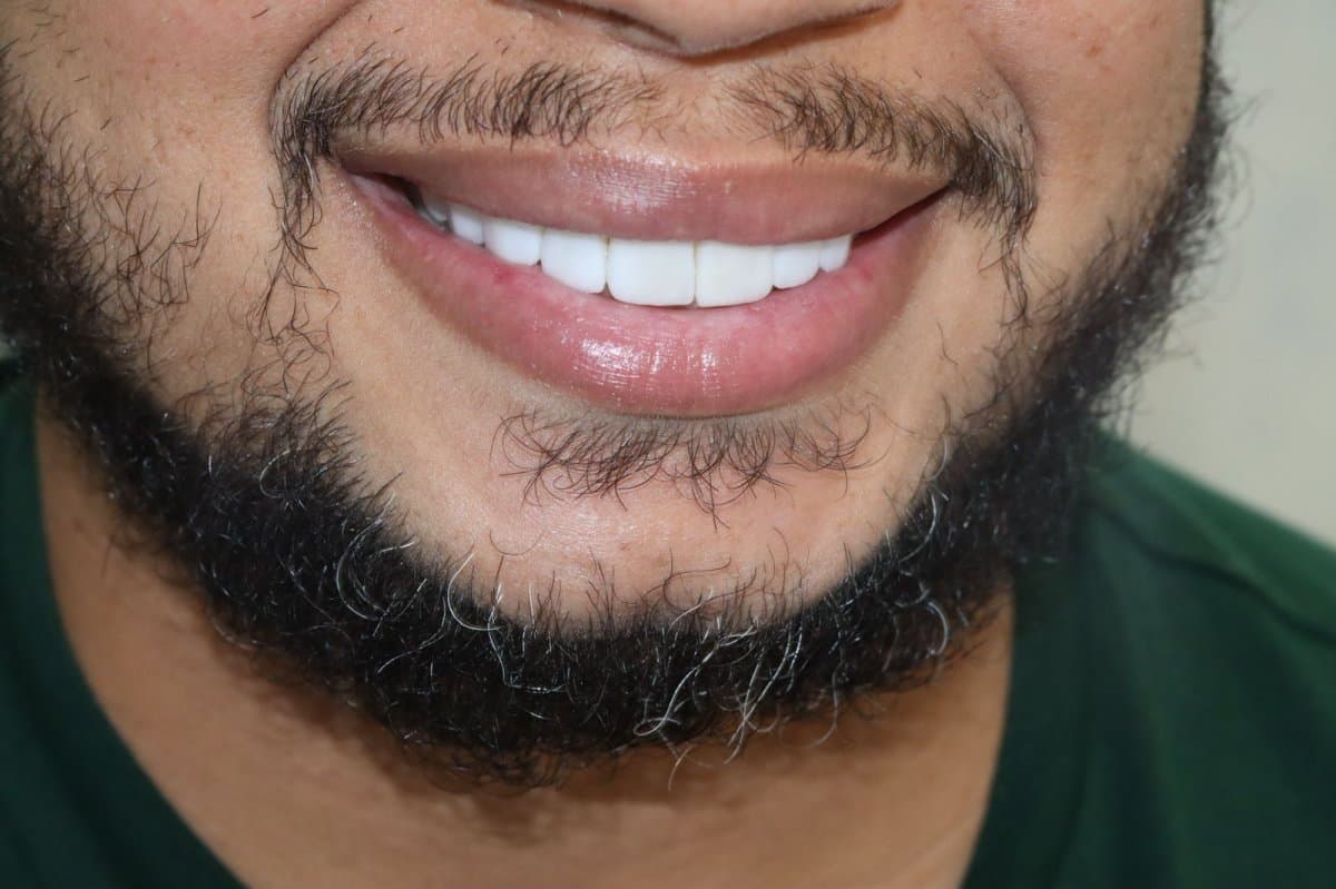 Transformative Results