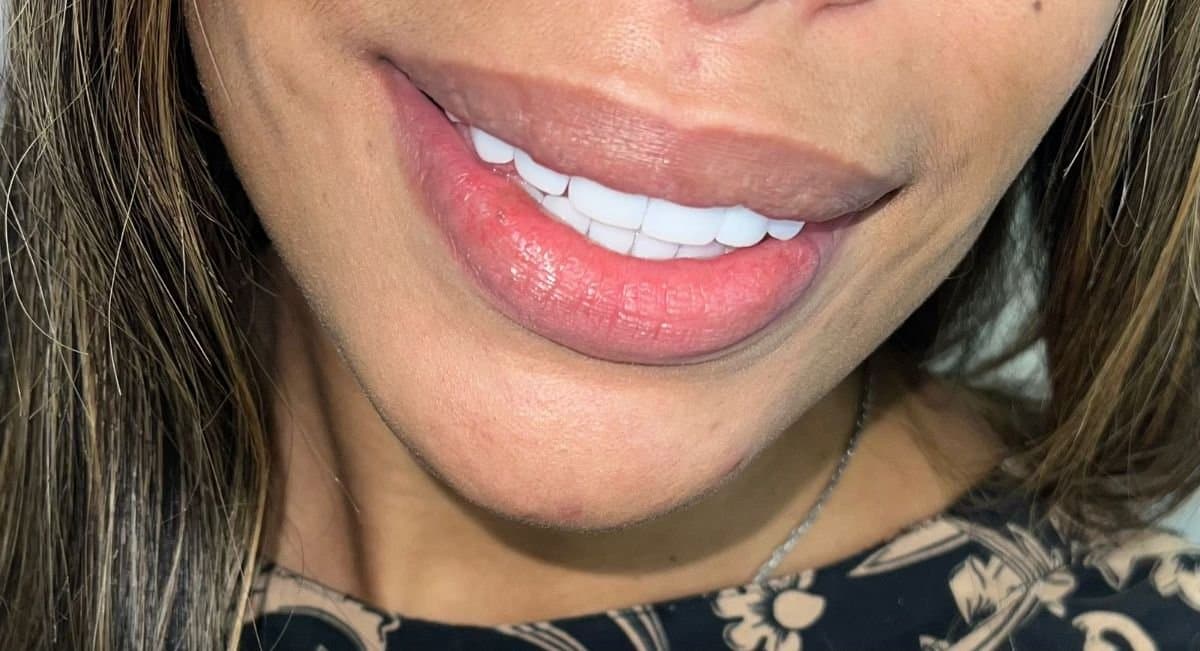 Transformative Results