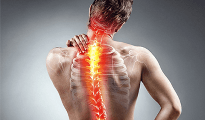Scoliosis Deformity Correction