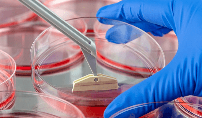 Stem Cell Infusion