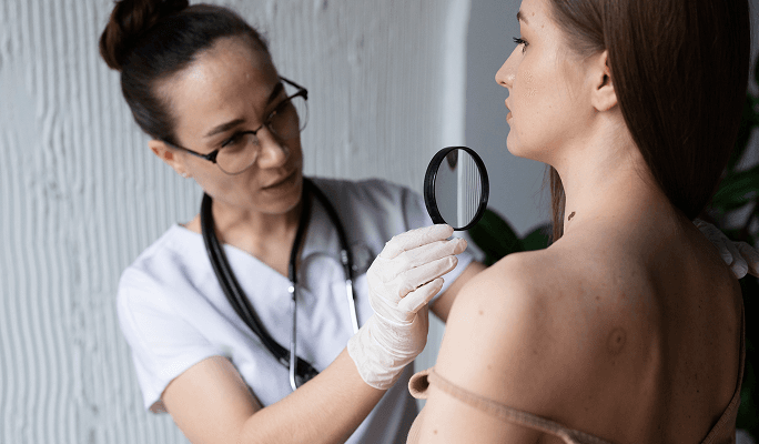 Skin Cancer