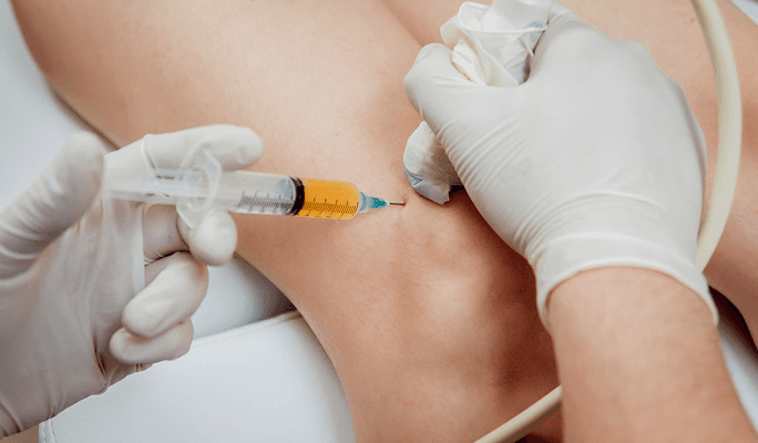 Sonographically Guided Injection