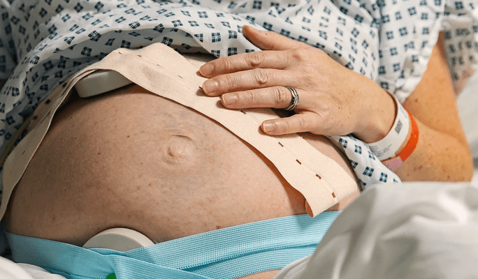 Tubal Ligation