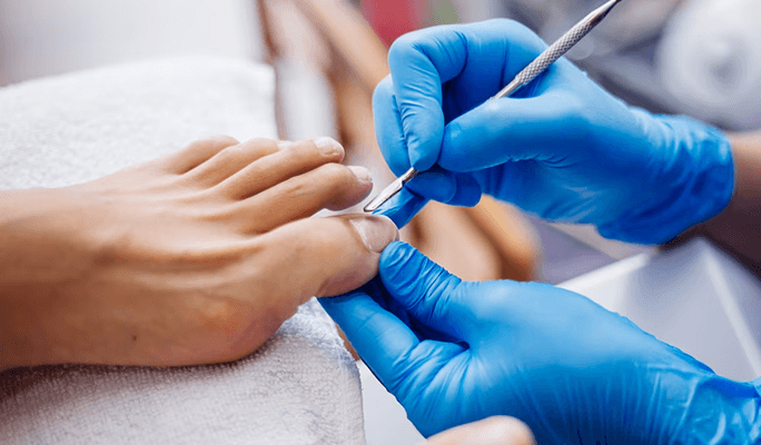 Laser Foot Surgery