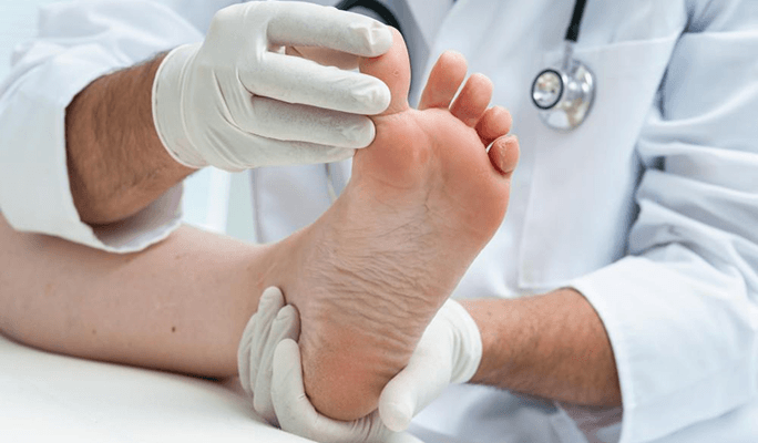 Ingrown Toenails