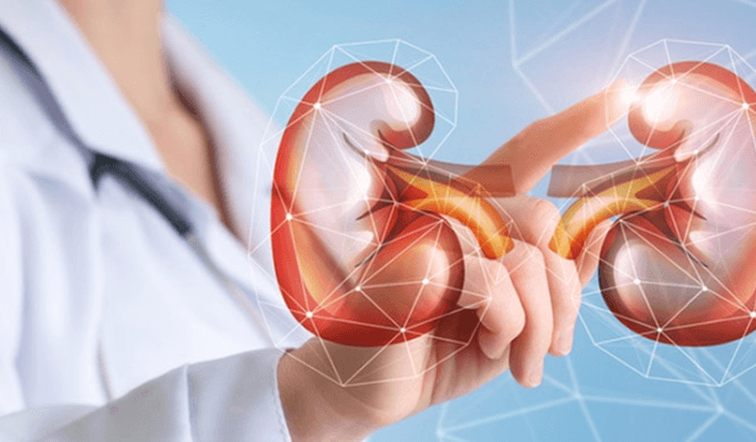 Kidney Transplant
