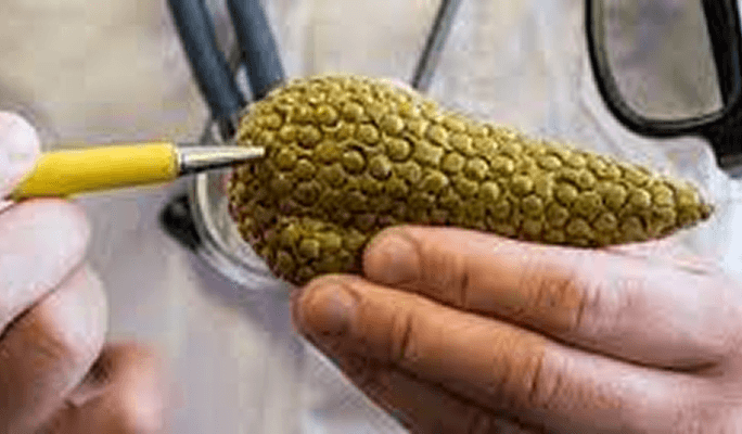 Pancreas Transplant