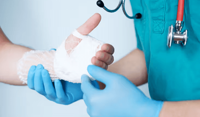 Ganglion Removal
