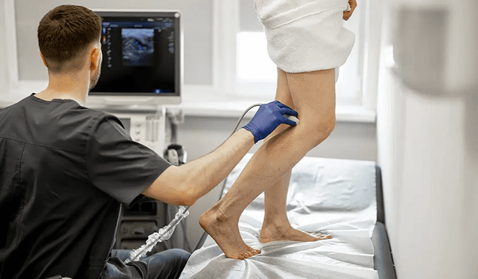 Vascular Stenting