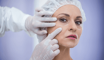 Eyelid Surgery (Blepharoplasty)