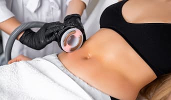 Body Contouring