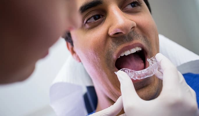 Invisalign